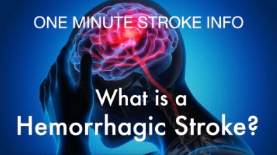 One Minute Stroke Info: What is a Hemorrhagic Stroke? | Cane and Able Stroke Recovery Group | CaneAndAble.org