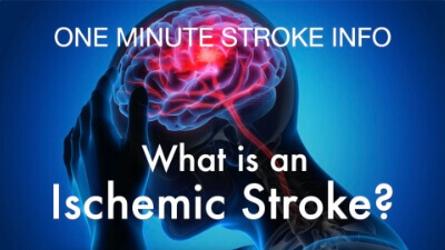 One Minute Stroke Info: What is an Ischemic Stroke? | Cane and Able Stroke Recovery Group | CaneAndAble.org